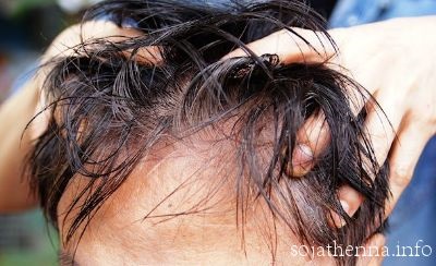 sojathenna�@60��j���̃w�i�P�A�ł�