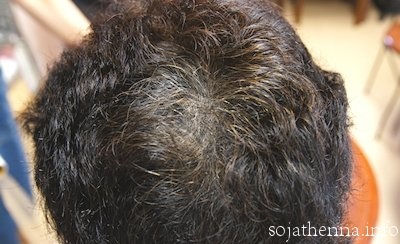 �\�W���b�g�w�i�@���̖т�����������ƒ����甒�����o�Ă��܂��B