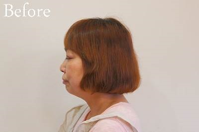 �G���[�g���e���l�ł̃A���J���J���[�ƃw�i�̕��p�����E��������