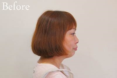 �G���[�g���e���l�ł̃A���J���J���[�ƃw�i�̕��p�����E��������